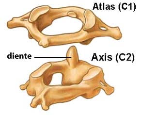 Atlas (C1) y Axis (C2) vertebras2